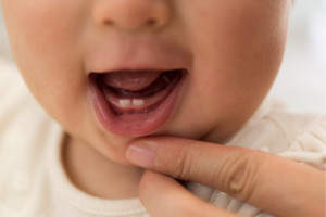 Baby's mouth open with two front teeth