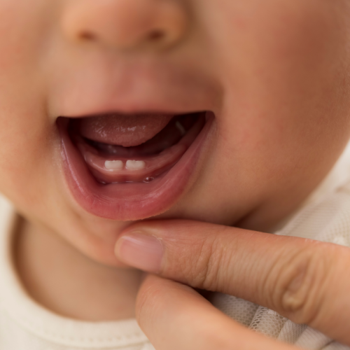 Baby's mouth open with two front teeth